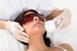 Carbon Peel in Madurai at Dermeon Advanced Skin & Hair Clinic
