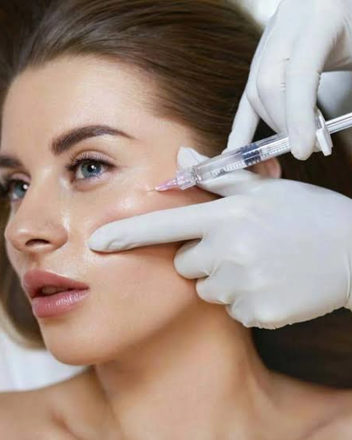 Fillers Treatment in Madurai at Dermeon Advanced Skin & Hair Clinic