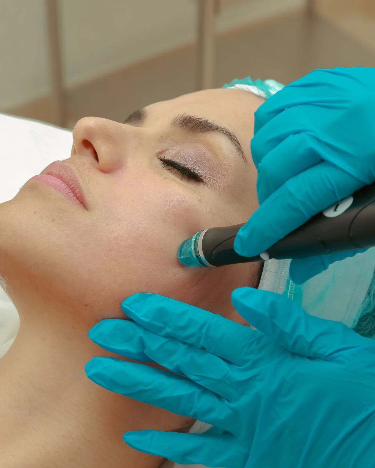 Hydra Facial in Madurai at Dermeon Advanced Skin & Hair Clinic