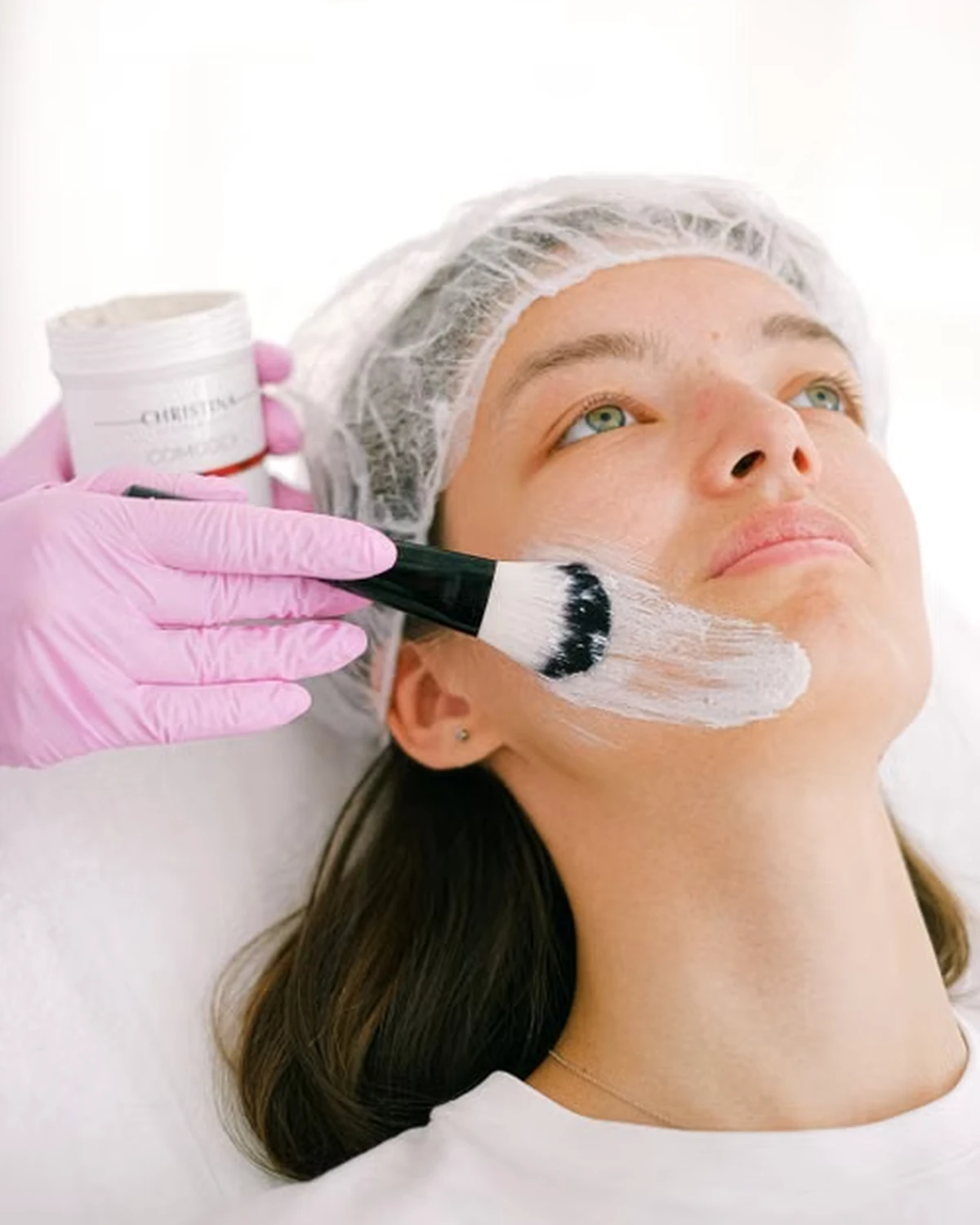 Skin Peels Treatment in Madurai at Dermeon Advanced Skin & Hair Clinic